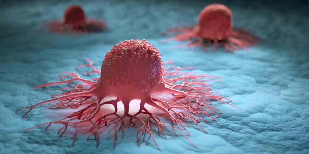 Image Of Cancer Cells From The Long Term Physical Effects Of Alcohol Abuse