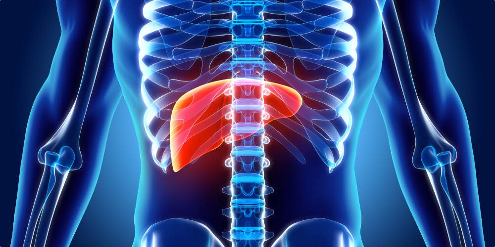 Image Of Liver Damage From The Long Term Physical Effects Of Alcohol Abuse