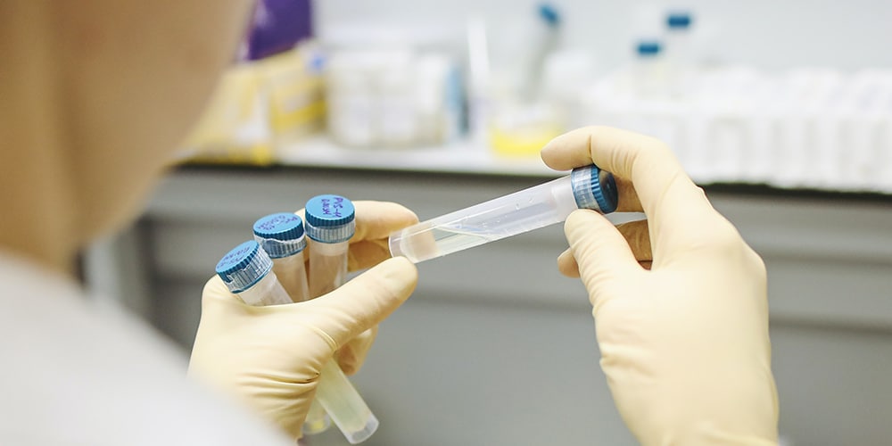 holding test tube urine samples to preparing for analysis