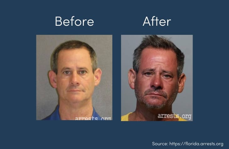 faces of addiction showing before and after alcohol abuse