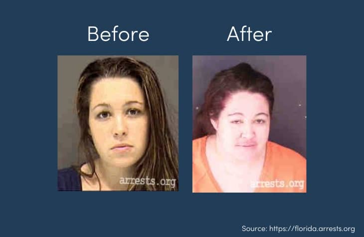 faces of addiction showing person before and after cocaine abuse