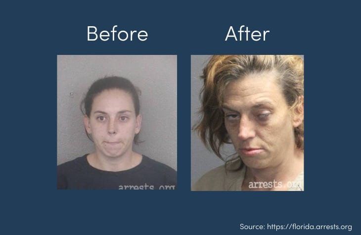 faces of addiction showing person before and after heroin abuse