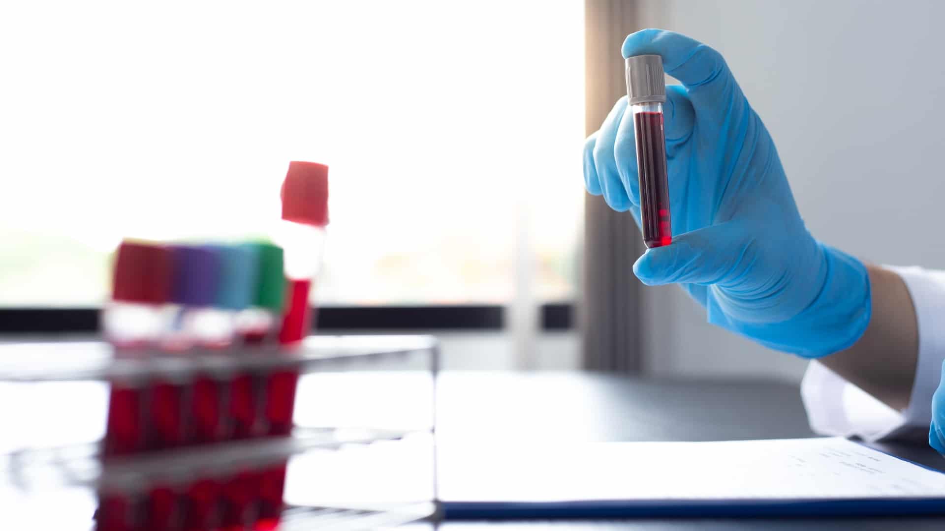 how long does ritalin stay in your system