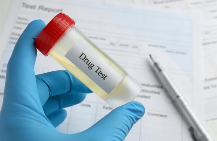 lab worker holding vial for drug test