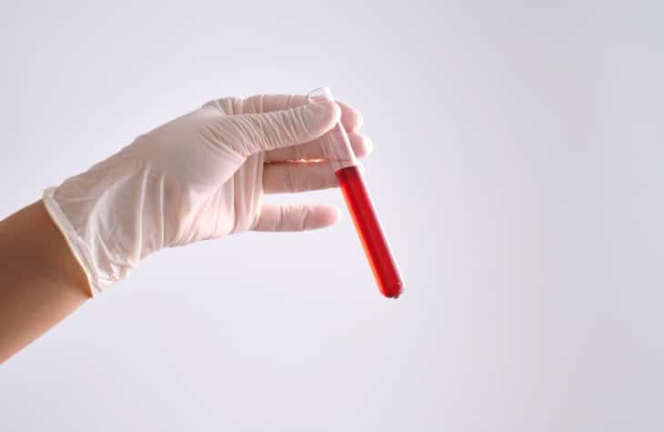 test tube with blood sample