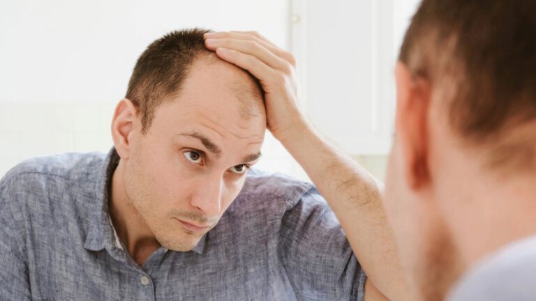 Young man looking at mirror worry about hair loss